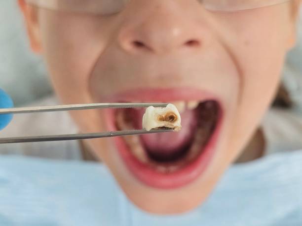 Best Walk-In Emergency Dentist in Riesel, TX